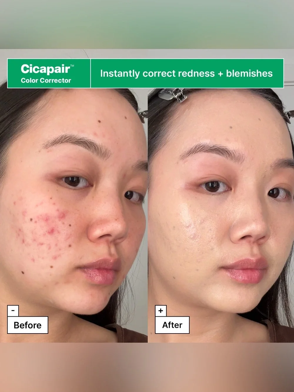 Dr. Jart+ Cicapair Redness Rescue Kit NIB